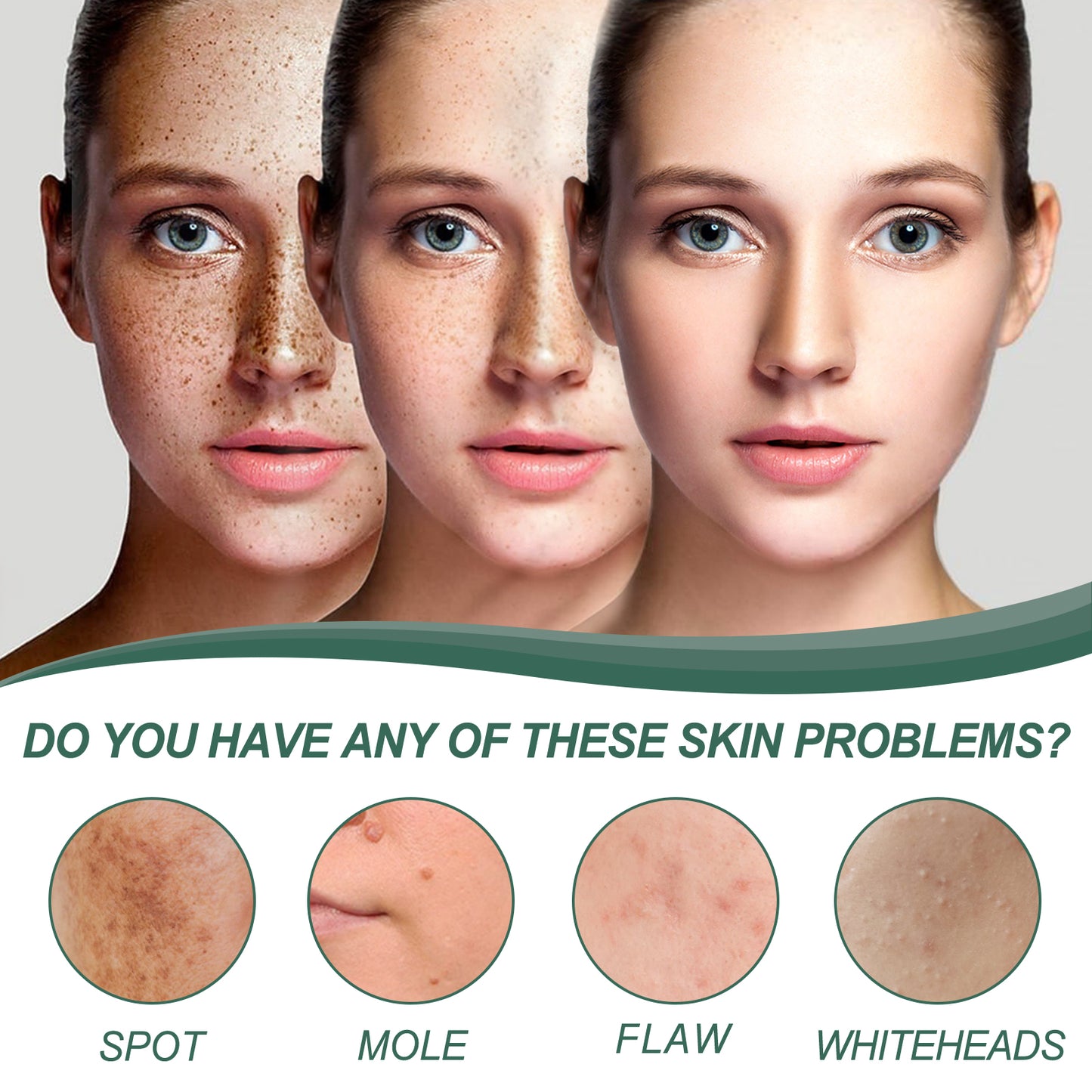 Herbal Natural Spot & Mole Cream, Blemishes Hydrating Whitening Brightening Cream - E-Esther Clothing Store